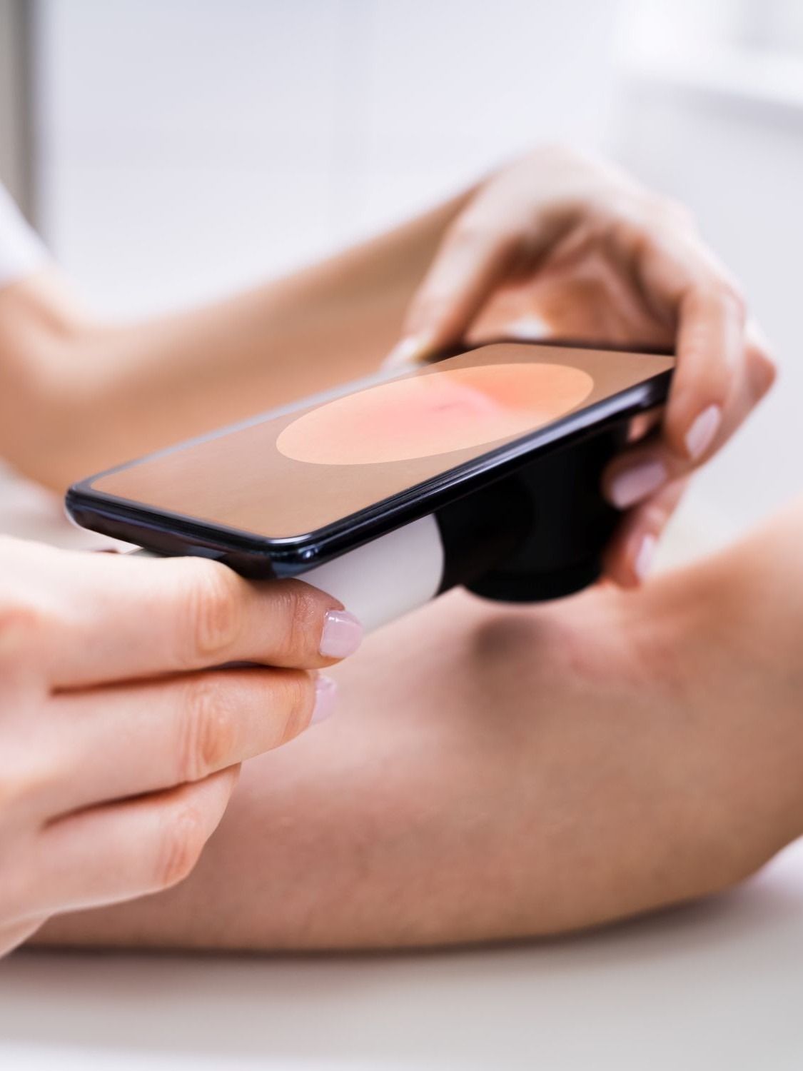 medical skin device