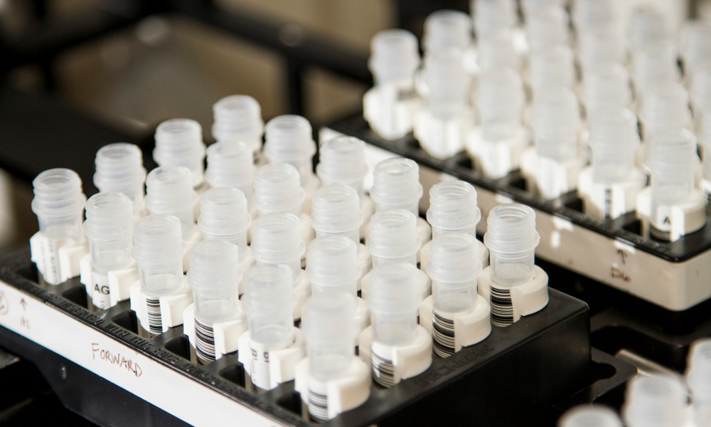 RARE - Lisa Deschamps