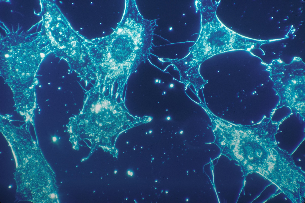 Fluorescent microscopy image showing interconnected human cells glowing blue and turquoise against a dark background, representing cellular biology, cancer research, biotechnology, or biomedical science.