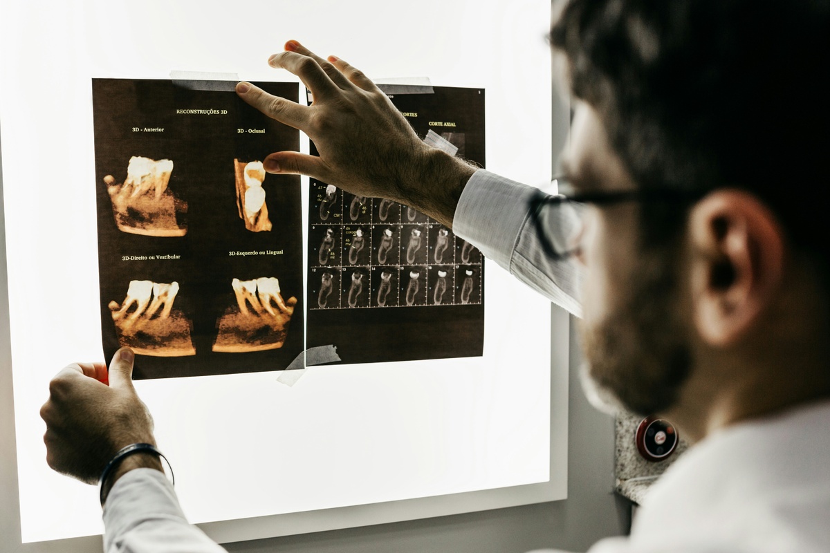 Brainomix
